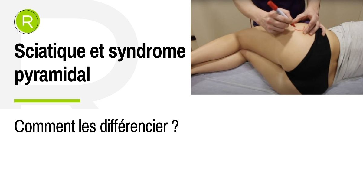 Comment faire la différence entre une sciatique et un syndrome pyramidal ?